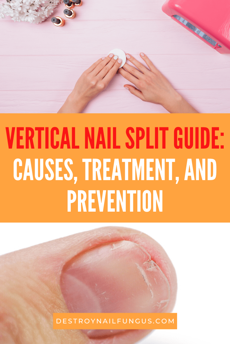 how to fix a vertical split nail