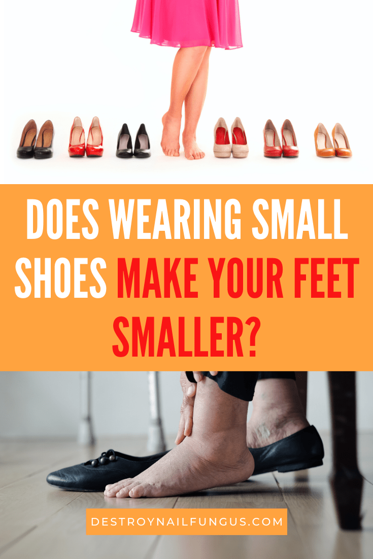 can your feet shrink if you wear small shoes