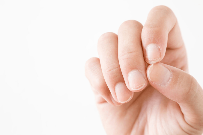 don't bite nails