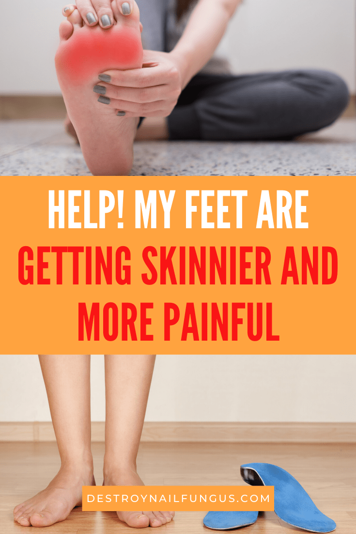 why are my feet so skinny