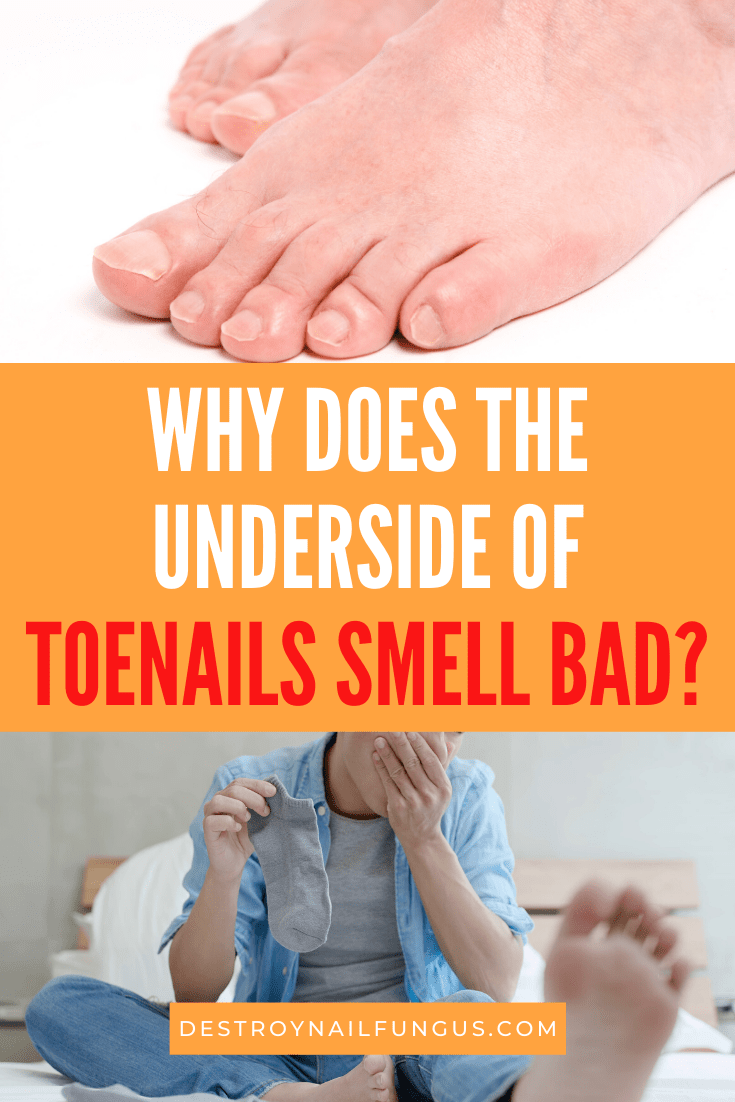 Smelly White Stuff under Toenails