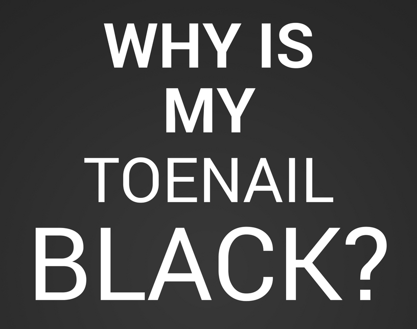black toenail