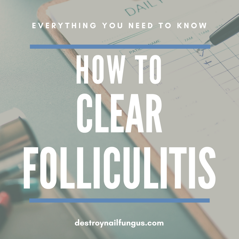 how to clear folliculitis