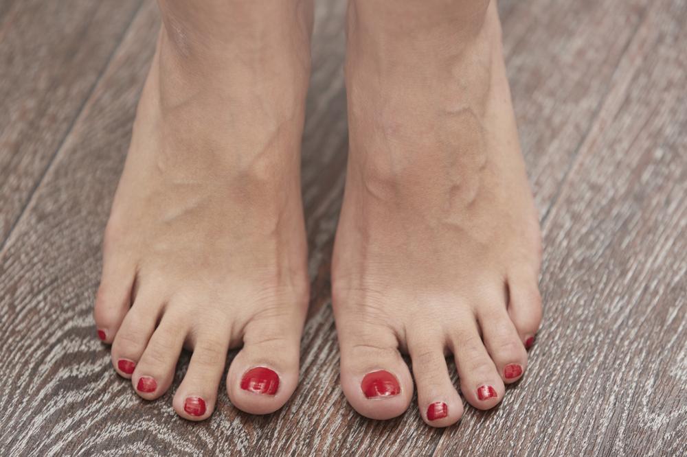 how to get rid of dry toenails