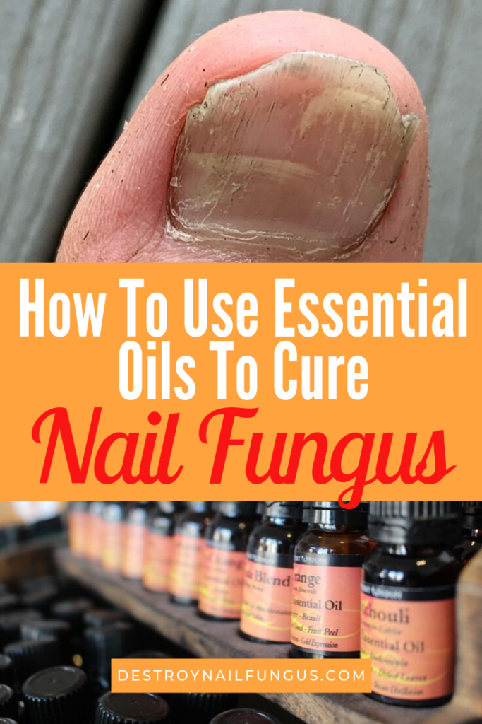 best essential oils for nail fungus