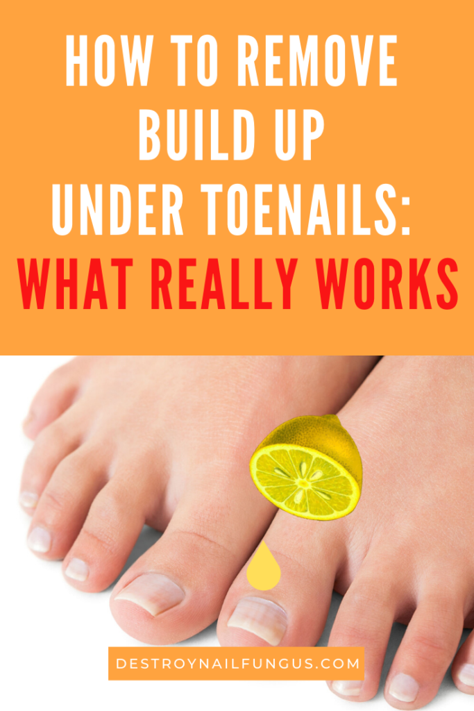 how to get rid of buildup under toenails