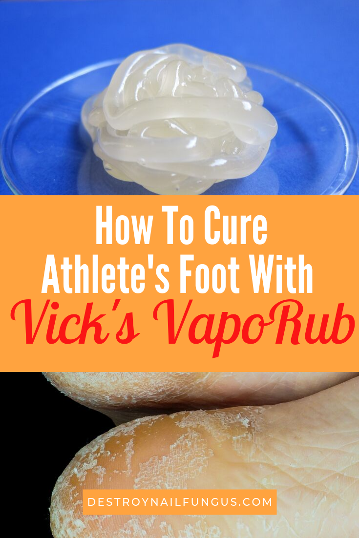 vicks vaporub athlete's foot