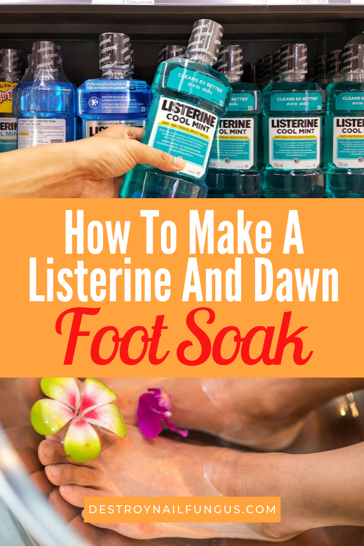 listerine and dawn foot soak