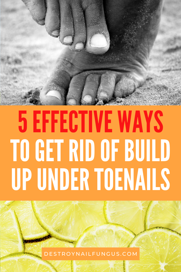 how to get rid of buildup under toenails