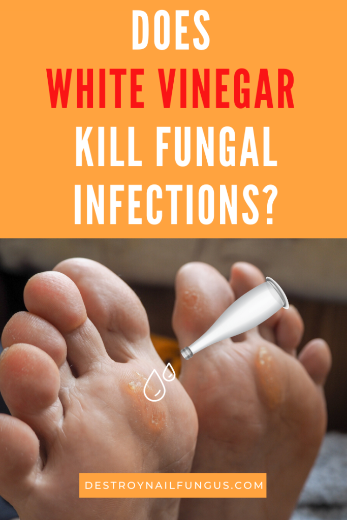 is white vinegar antifungal
