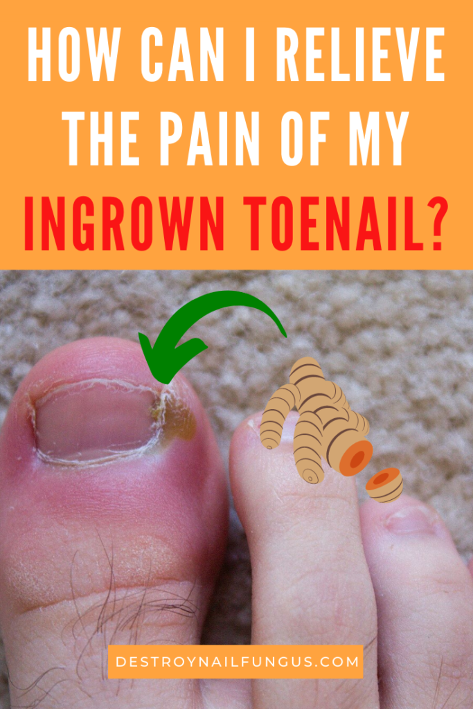 ingrown toenail pain relief fast