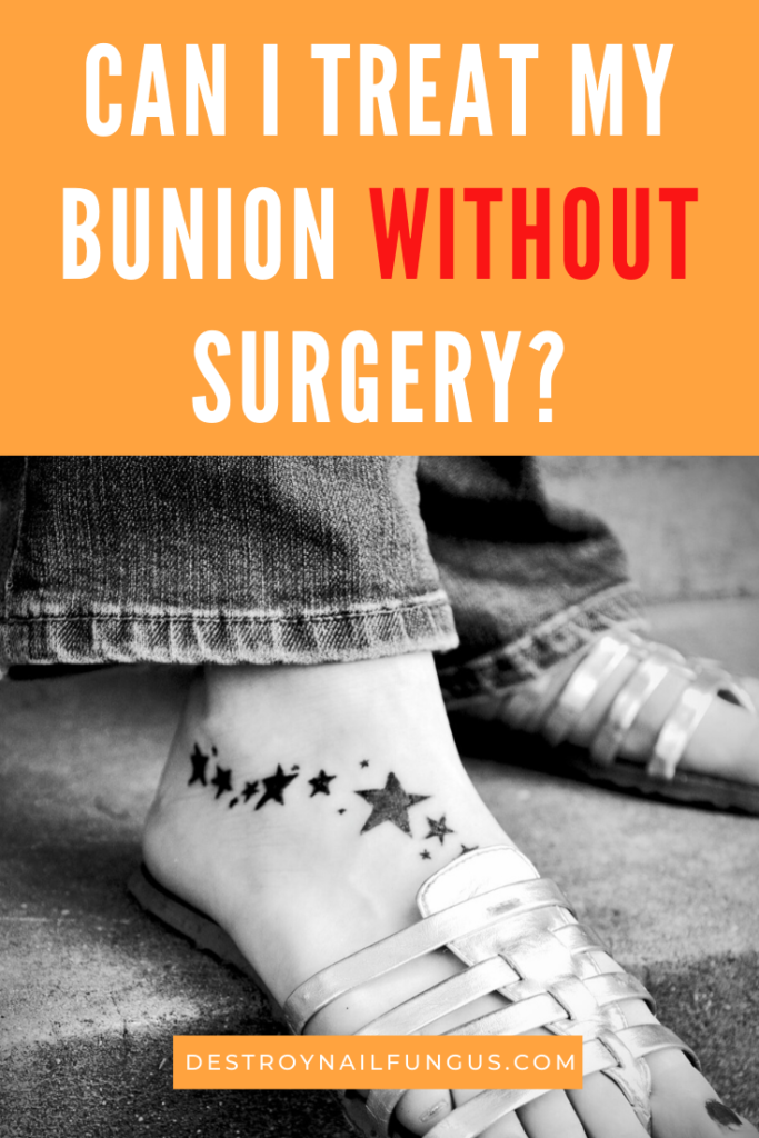 can bunions be reversed