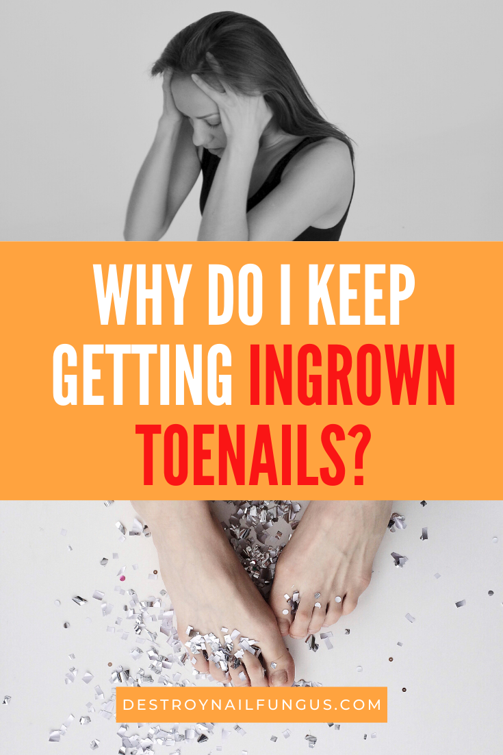 are ingrown toenails contagious