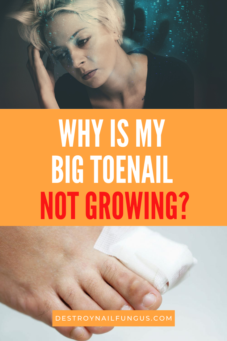 big toenail won’t grow