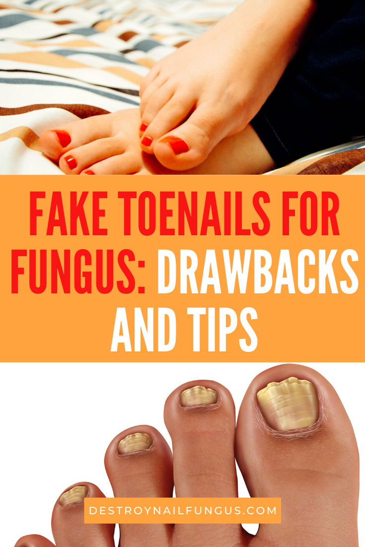 fake toenails for fungus