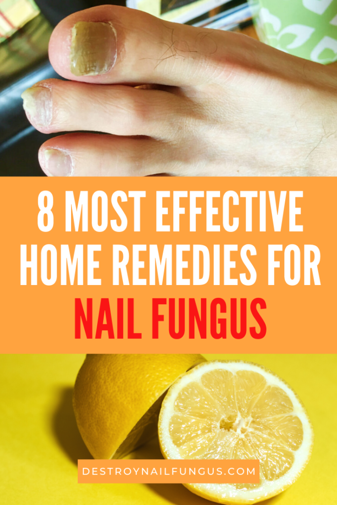 One Cup Of This Will Destroy Your Nail Fungus: Know The Truth