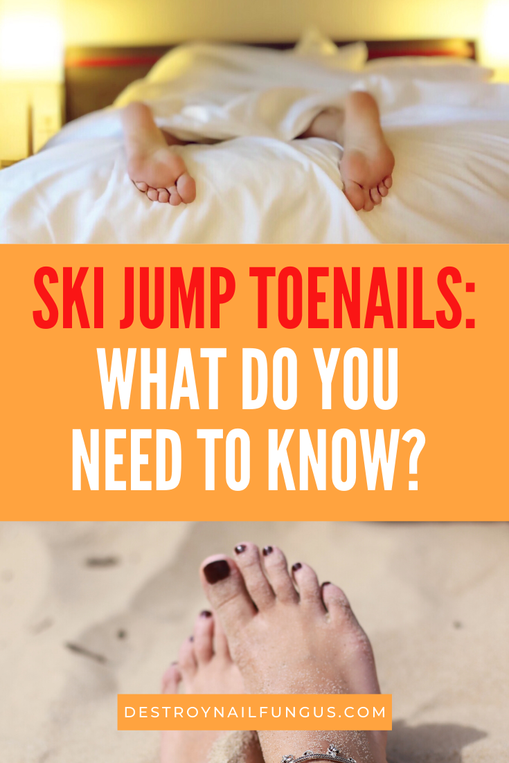 ski jump toenails