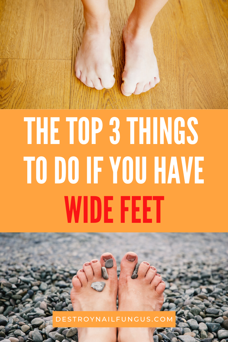 how to get rid of wide feet