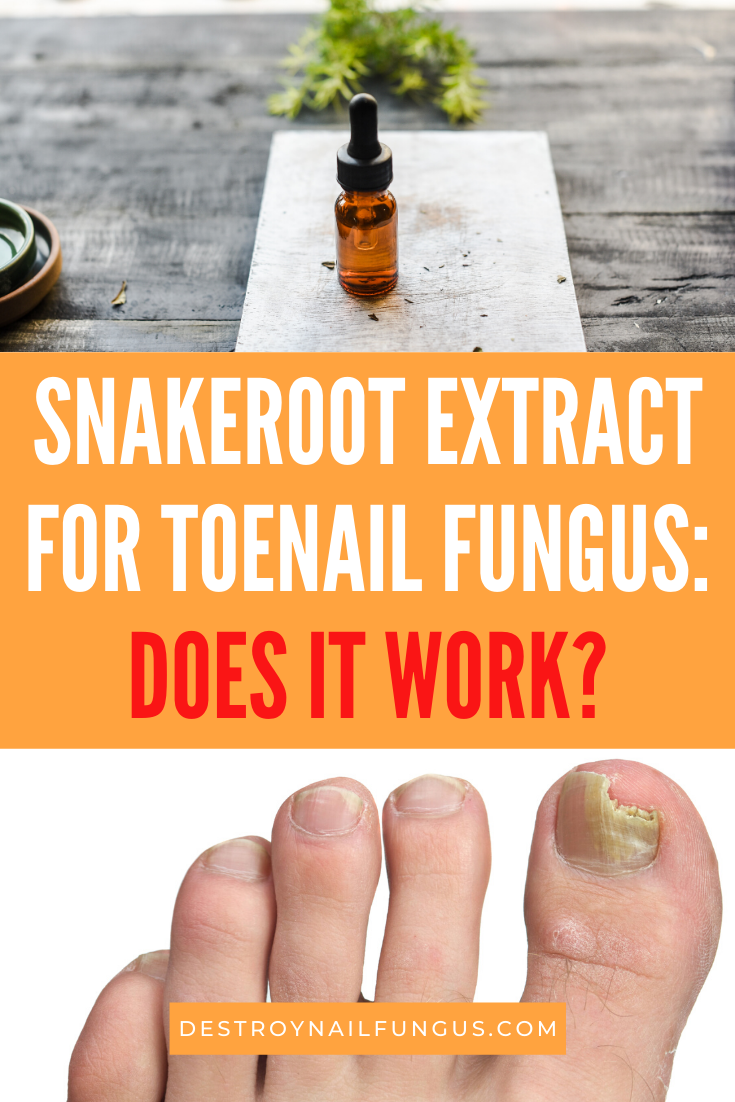 how to use snakeroot extract for toenail fungus