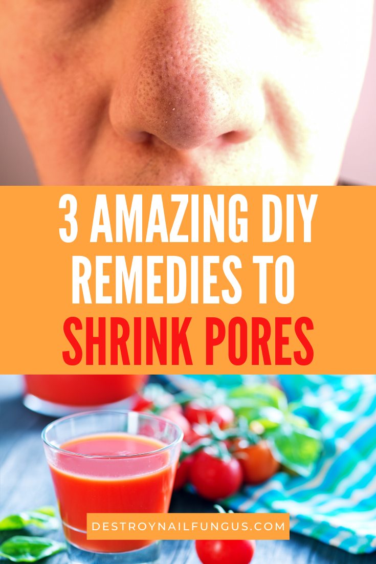 how to shrink pores diy