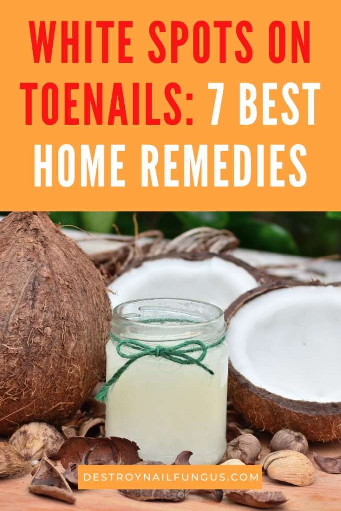 home remedies white spots on toenails