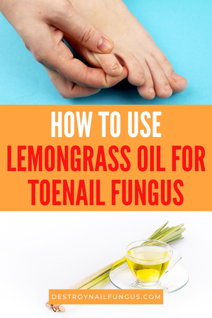lemongrass oil for toenail fungus