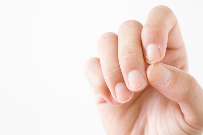 peeling fingernails home remedies