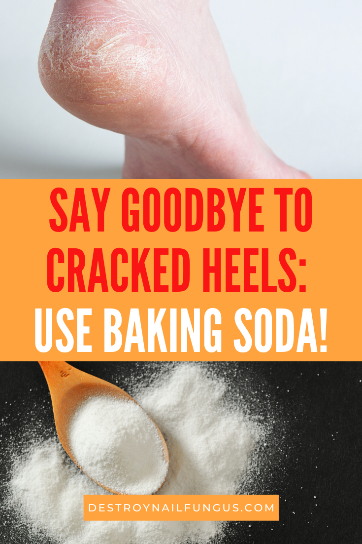 baking soda for dry cracked feet