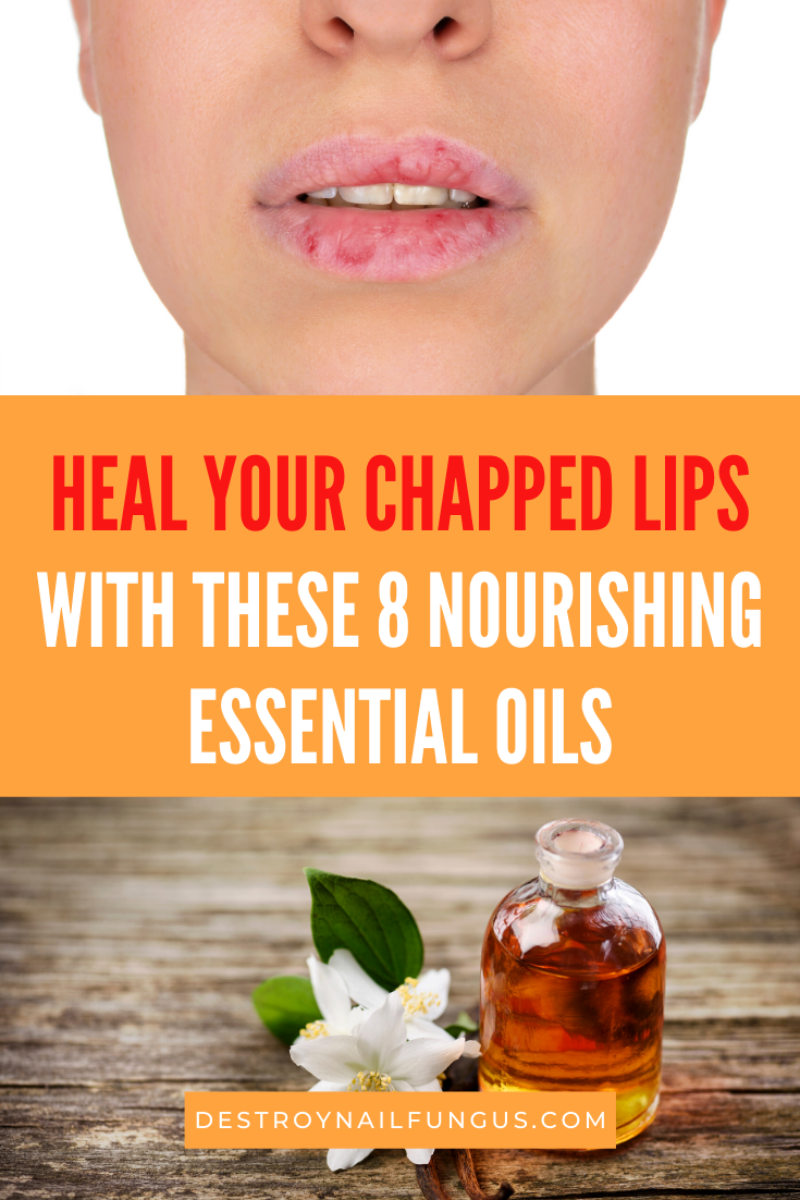 best essential oils for chapped lips