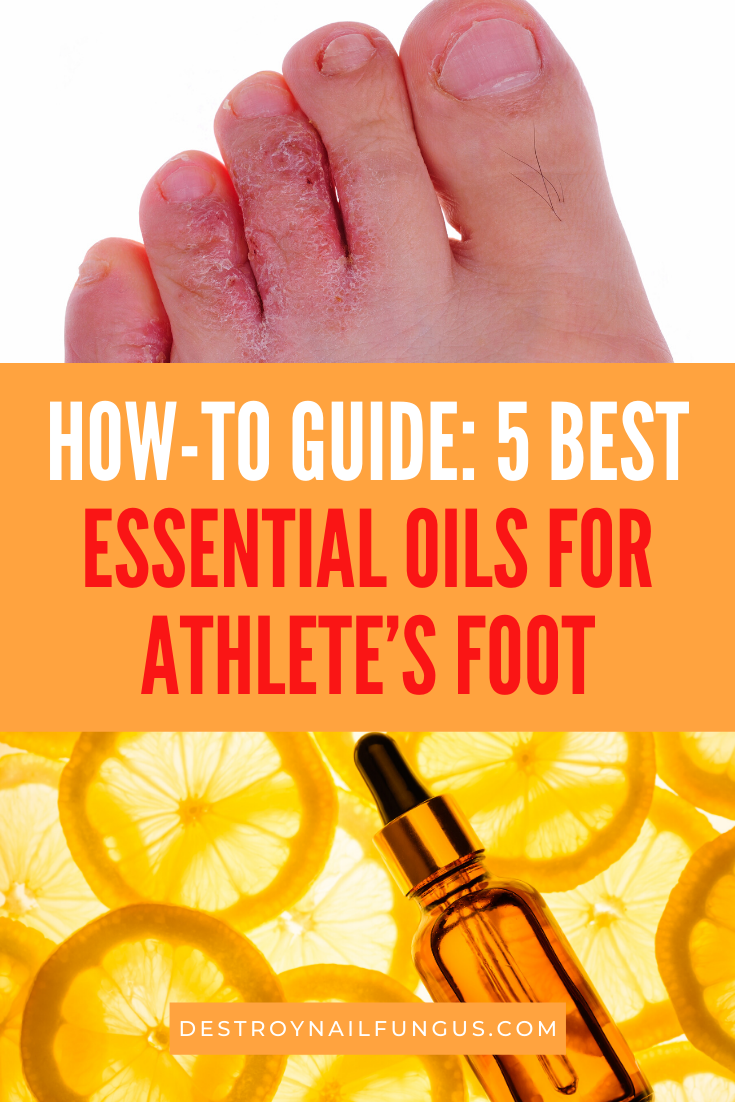 essential oils for athletes foot