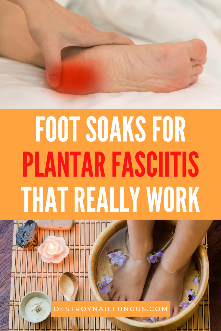 foot soaks for plantar fasciitis