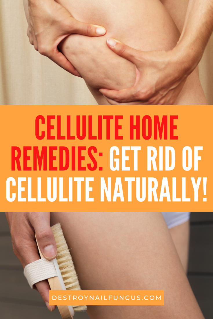 how to get rid of cellulite on thighs home remedies