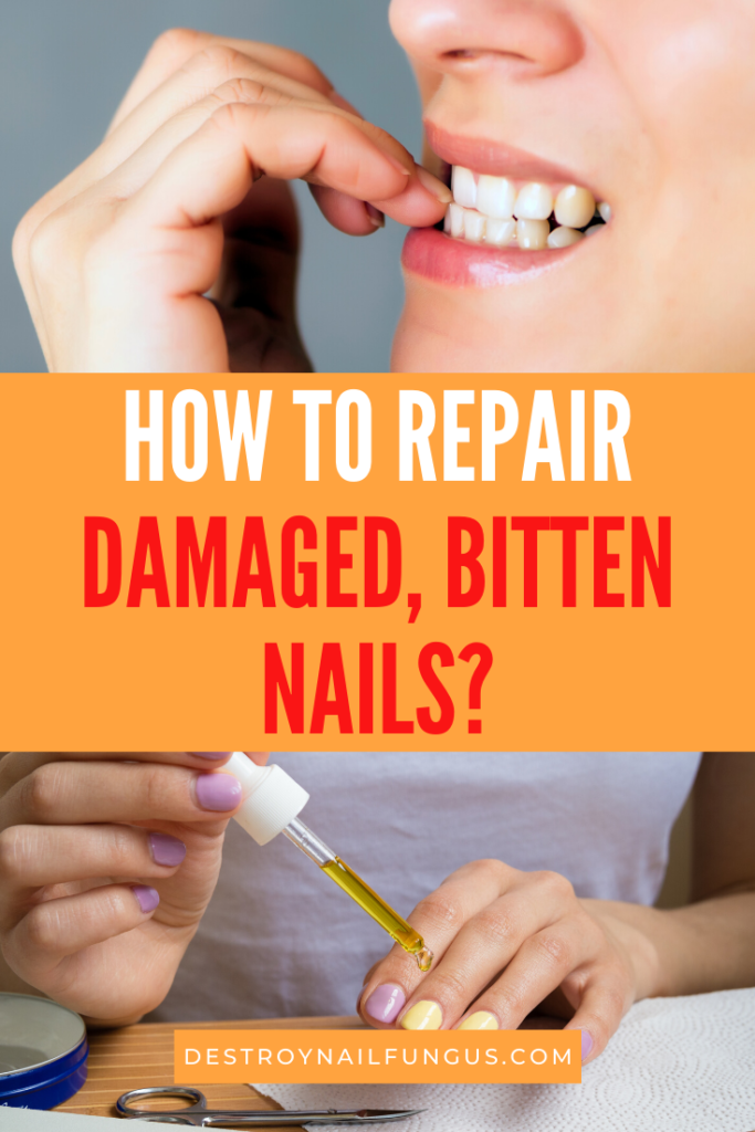 How To Repair Damaged Nails From Biting: A Complete Guide