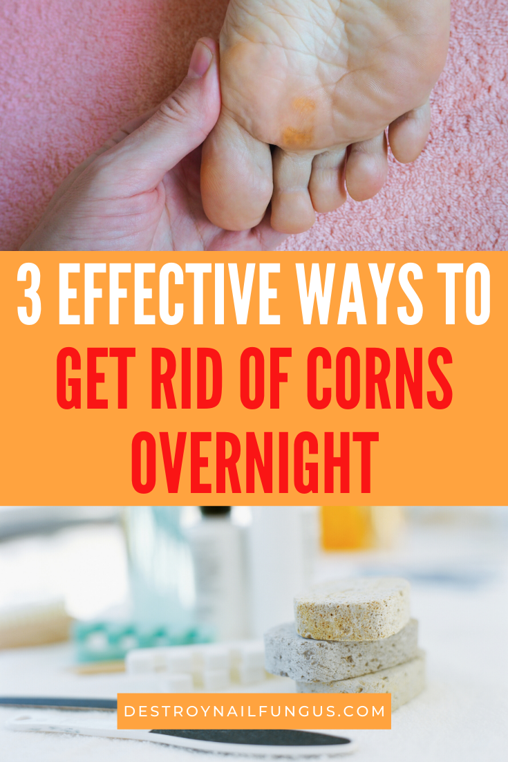 remove corns on feet overnight