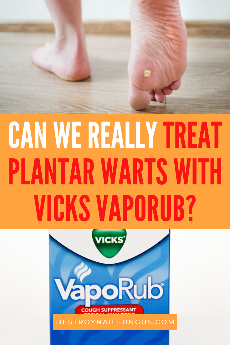 vicks vaporub for plantar warts