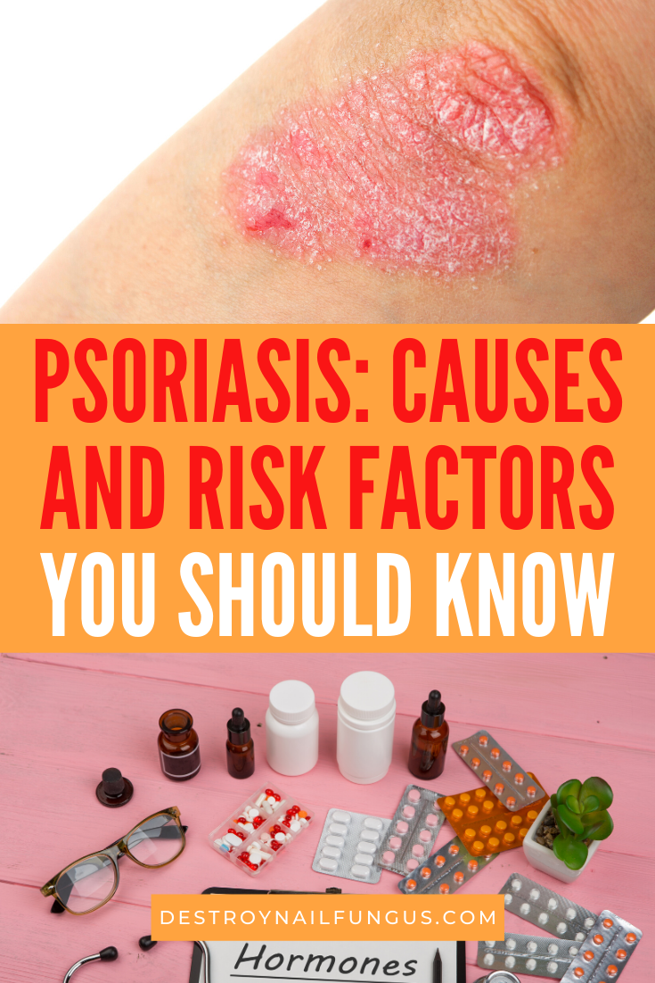what causes psoriasis
