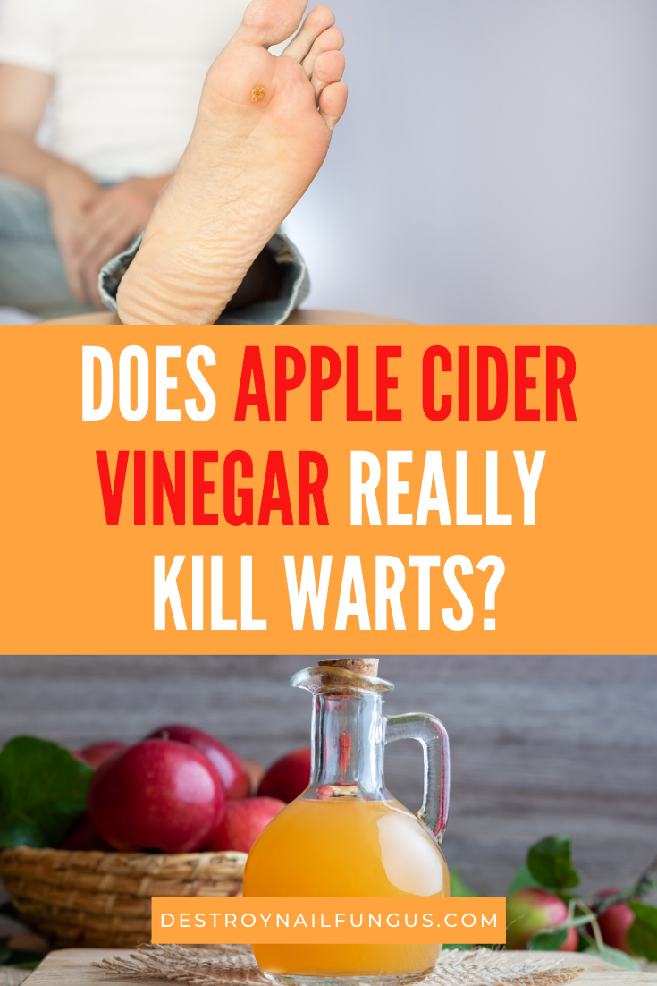 why do warts turn black with apple cider vinegar